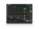 Mindray UMEC12 Multi-Parameter Monitor