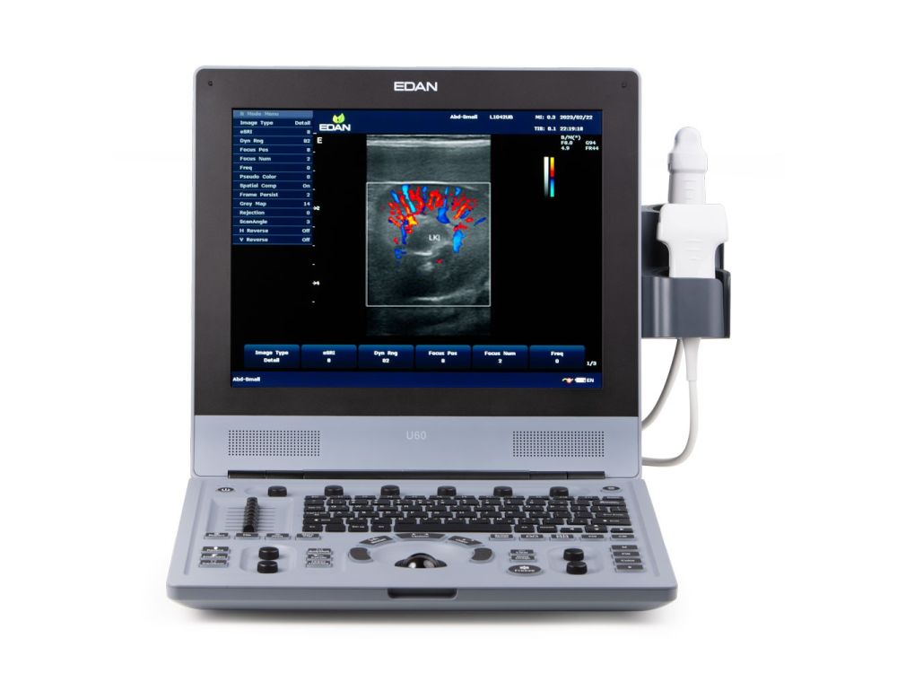 Edan U60 VET Ultrasound Machine