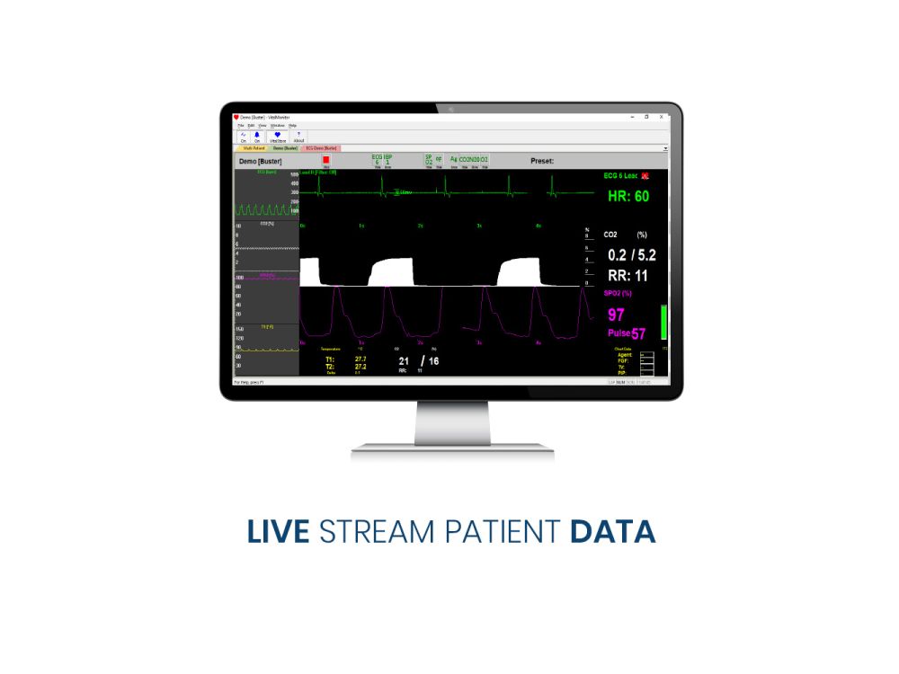 Vetronic Lightning Multi-Parameter Monitor with Software included